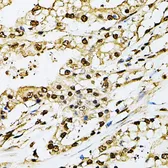 Anti-PSMB1 antibody used in IHC (Paraffin sections) (IHC-P). GTX54643