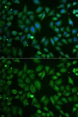Anti-Chromogranin C antibody used in Immunocytochemistry/ Immunofluorescence (ICC/IF). GTX54665