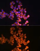 Anti-RRM1 antibody used in Immunocytochemistry/ Immunofluorescence (ICC/IF). GTX54666