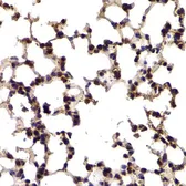 Anti-Splicing factor 1 antibody used in IHC (Paraffin sections) (IHC-P). GTX54670