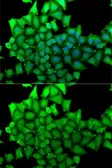 Anti-HCE antibody used in Immunocytochemistry/ Immunofluorescence (ICC/IF). GTX54686