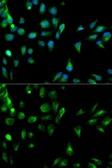 Anti-RASSF1 antibody used in Immunocytochemistry/ Immunofluorescence (ICC/IF). GTX54696