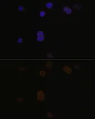 Anti-Recoverin antibody used in Immunocytochemistry/ Immunofluorescence (ICC/IF). GTX54724