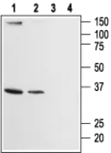 Anti-ORAI2 antibody used in Western Blot (WB). GTX54767