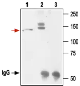 Anti-Kv11.1 antibody used in Immunoprecipitation (IP). GTX54776