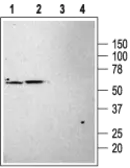 Anti-KCNK3 antibody used in Western Blot (WB). GTX54778