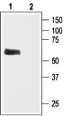 Anti-GIRK1 antibody used in Western Blot (WB). GTX54831