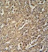 Anti-ENGase antibody used in IHC (Paraffin sections) (IHC-P). GTX54877
