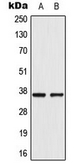 Anti-AKR1CL2 antibody used in Western Blot (WB). GTX54889