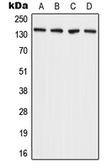 Anti-ADAMTS2 antibody used in Western Blot (WB). GTX54941