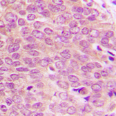 Anti-PBK (phospho Thr9) antibody used in IHC (Paraffin sections) (IHC-P). GTX54960