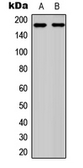 Anti-Ret (phospho Tyr1062) antibody used in Western Blot (WB). GTX54984