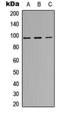 Anti-Insulin Receptor beta (phospho Tyr1316) antibody used in Western Blot (WB). GTX55014