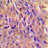 Anti-IKK alpha (phospho Thr23) antibody used in IHC (Paraffin sections) (IHC-P). GTX55094