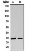 Anti-B3GALT1 antibody used in Western Blot (WB). GTX55180