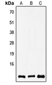 Anti-COX8A antibody used in Western Blot (WB). GTX55216