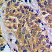 Anti-HEXB antibody used in IHC (Paraffin sections) (IHC-P). GTX55224