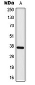 Anti-ELOVL4 antibody used in Western Blot (WB). GTX55225