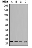 Anti-FGF6 antibody used in Western Blot (WB). GTX55265