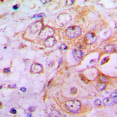 Anti-PFKFB2 antibody used in IHC (Paraffin sections) (IHC-P). GTX55273