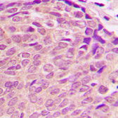 Anti-PDK2 antibody used in IHC (Paraffin sections) (IHC-P). GTX55290