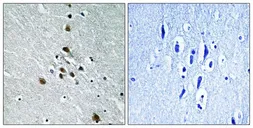 Anti-Splicing factor 1 (phospho Ser82) antibody used in IHC (Paraffin sections) (IHC-P). GTX55309