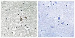 Anti-IRAK1 (phospho Ser376) antibody used in IHC (Paraffin sections) (IHC-P). GTX55332