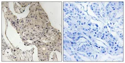 Anti-GAB2 (phospho Ser623) antibody used in IHC (Paraffin sections) (IHC-P). GTX55362