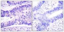 Anti-WAVE1 (phospho Tyr125) antibody used in IHC (Paraffin sections) (IHC-P). GTX55451