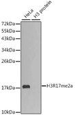 Anti-Histone H3R17me2 (di-methyl Arg17) antibody used in Western Blot (WB). GTX55484