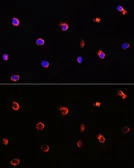 Anti-AIPL1 antibody used in Immunocytochemistry/ Immunofluorescence (ICC/IF). GTX55497