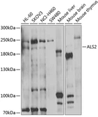 Anti-ALS2 antibody used in Western Blot (WB). GTX55506