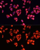 Anti-Angiopoietin 2 antibody used in Immunocytochemistry/ Immunofluorescence (ICC/IF). GTX55512