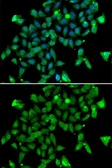 Anti-Aspartoacylase antibody used in Immunocytochemistry/ Immunofluorescence (ICC/IF). GTX55521