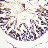 Anti-ATG10 antibody used in IHC (Paraffin sections) (IHC-P). GTX55523