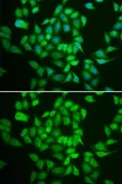 Anti-Casein Kinase 1 epsilon antibody used in Immunocytochemistry/ Immunofluorescence (ICC/IF). GTX55549