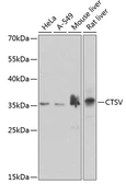 Anti-Cathepsin V antibody used in Western Blot (WB). GTX55550