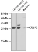 Anti-CRISP2 antibody used in Western Blot (WB). GTX55579