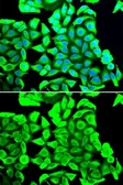 Anti-DCD antibody used in Immunocytochemistry/ Immunofluorescence (ICC/IF). GTX55585