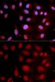 Anti-DNA polymerase beta antibody used in Immunocytochemistry/ Immunofluorescence (ICC/IF). GTX55594