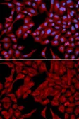 Anti-DCTN2 antibody used in Immunocytochemistry/ Immunofluorescence (ICC/IF). GTX55598