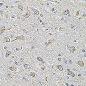 Anti-FASTKD1 antibody used in IHC (Paraffin sections) (IHC-P). GTX55617