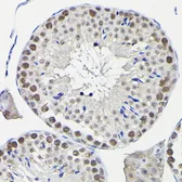 Anti-KPNA3 antibody used in IHC (Paraffin sections) (IHC-P). GTX55685