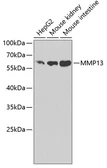 Anti-MMP13 antibody used in Western Blot (WB). GTX55707