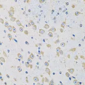 Anti-MSRA antibody used in IHC (Paraffin sections) (IHC-P). GTX55713