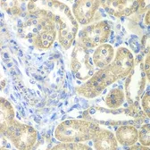 Anti-NDUFV2 antibody used in IHC (Paraffin sections) (IHC-P). GTX55724