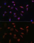 Anti-PDCD5 antibody used in Immunocytochemistry/ Immunofluorescence (ICC/IF). GTX55740