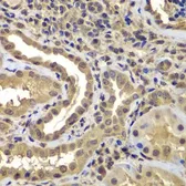 Anti-PSMB8 antibody used in IHC (Paraffin sections) (IHC-P). GTX55763