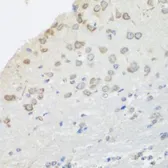 Anti-Pumilio 1 antibody used in IHC (Paraffin sections) (IHC-P). GTX55768