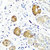 Anti-SGSH antibody used in IHC (Paraffin sections) (IHC-P). GTX55796
